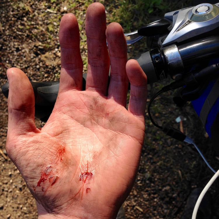 Dan's left hand with various small cuts from the fall.